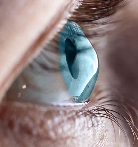 Eye Disease Diagnosis & Management in Laguna Niguel